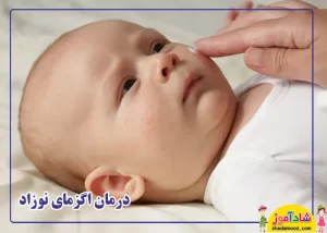 درمان اگزمای نوزاد